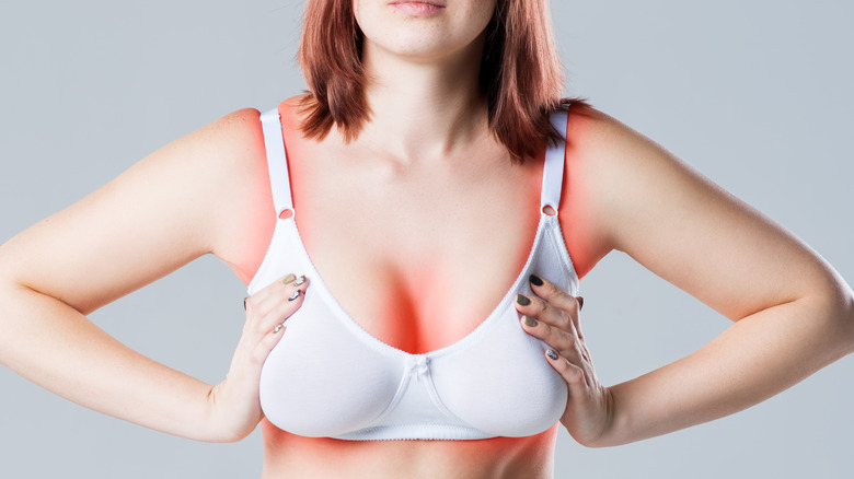 woman with irritated skin under bra