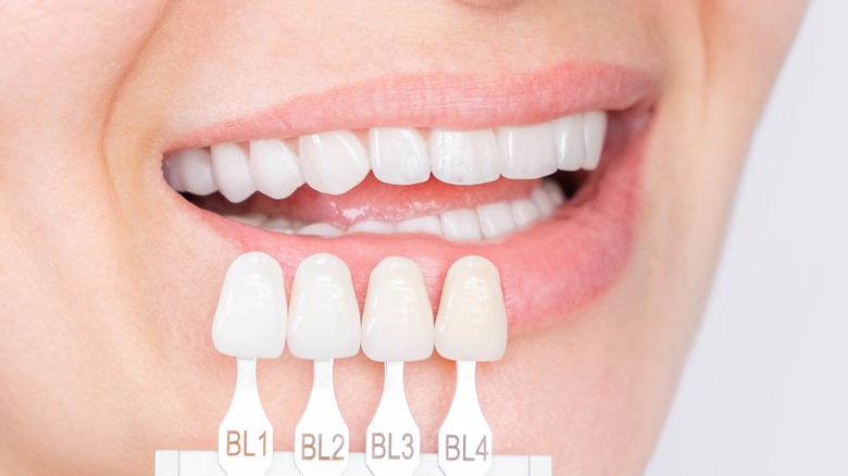 close-up female mouth with teeth whitening color chart