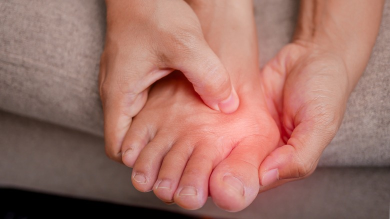 person holding swollen bunion