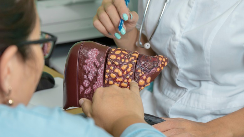 Doctor examining liver model