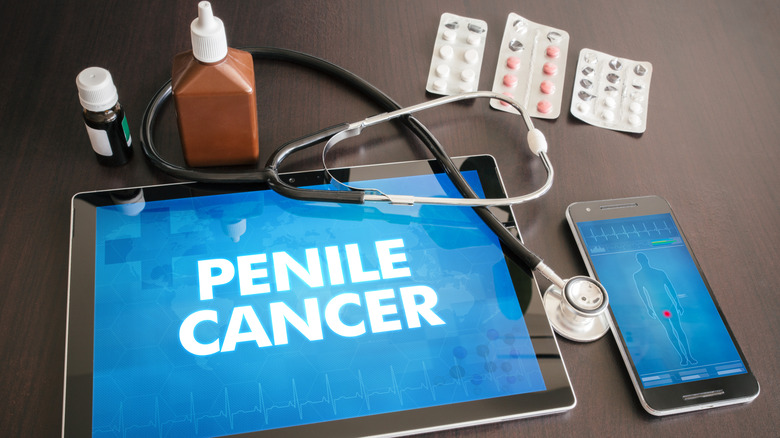 Penile cancer diagnosis on tablet next to stethoscope and pills