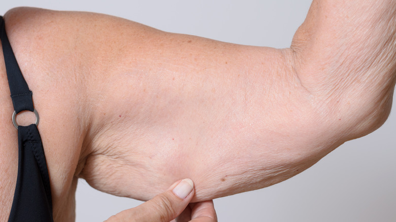 woman showing flabby triceps