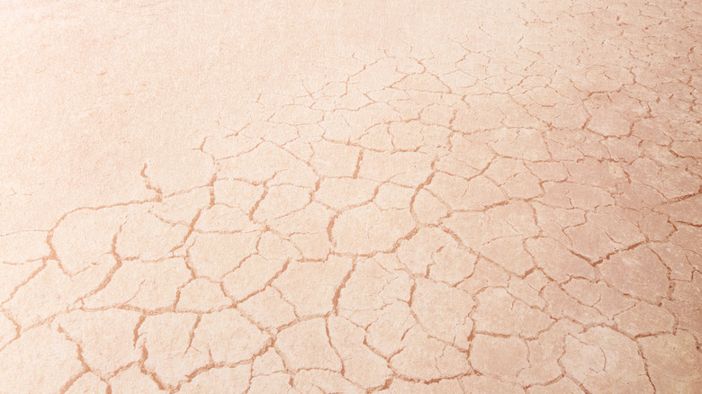 dry skin surface 