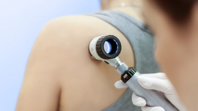 A doctor examines a patients skin