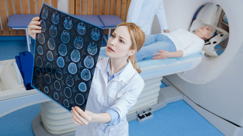 Doctor examining brain scan 