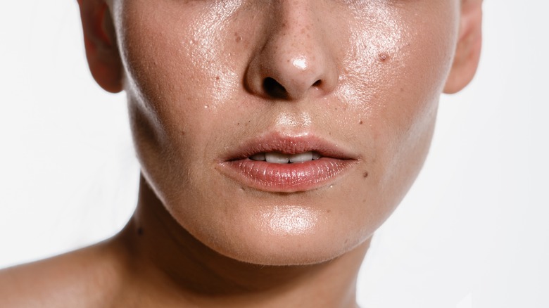 person with oily skin in closeup 