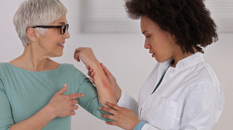 Doctor examining patient rash