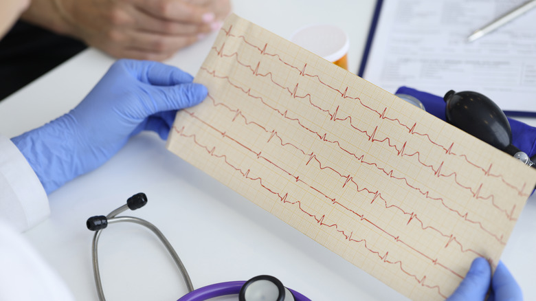 electrocardiogram