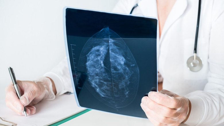 Doctor examining mammogram X-ray