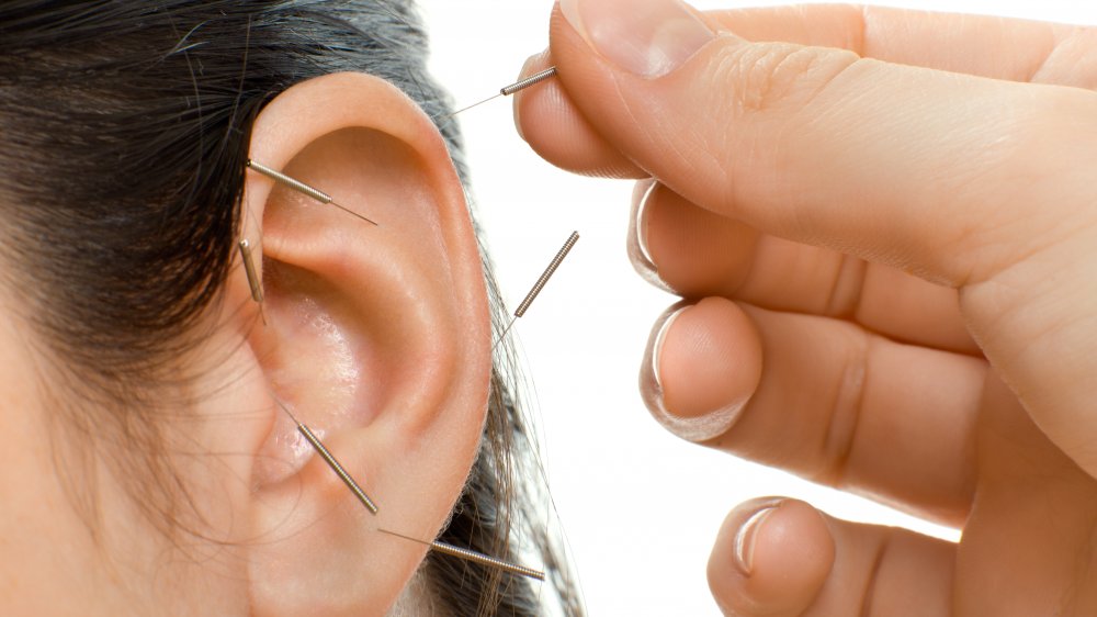 Person receives acupuncture in the ear