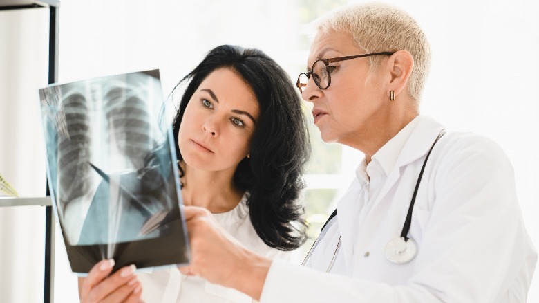 doctors examine x-ray for tuberculosis