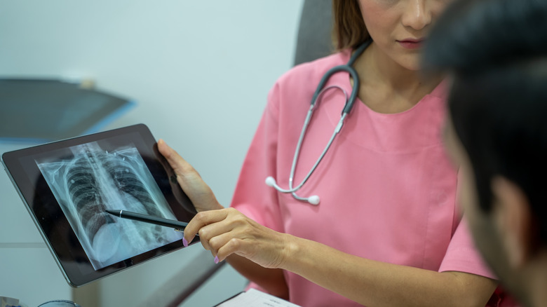 A medical professional pointing out a lung X-ray