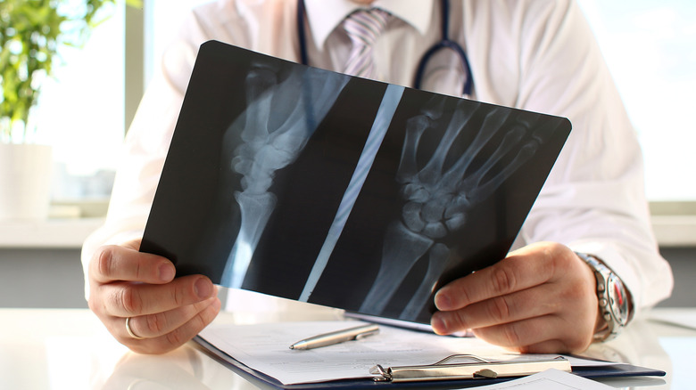A doctor holds an x-ray of a foot and hand