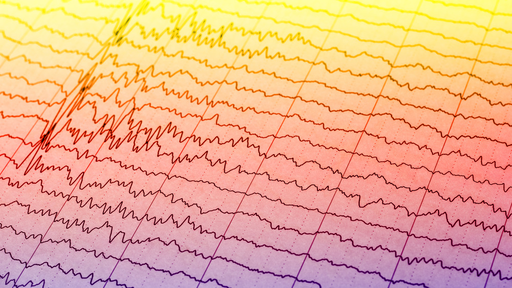 EEG brainwaves scan