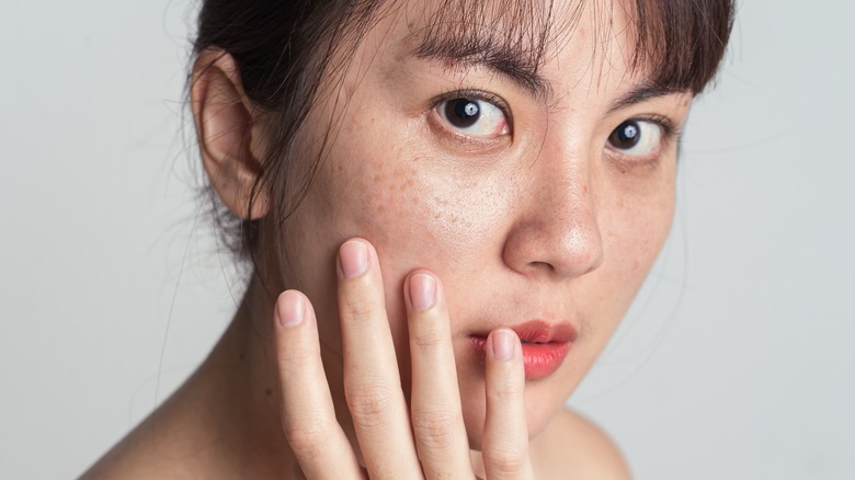 Woman with freckles applying serum