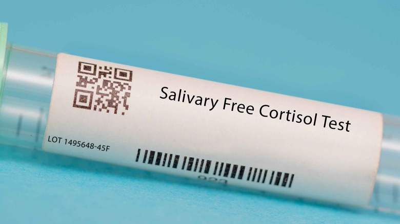 Tube labeled "Salivary Free Cortisol Test"