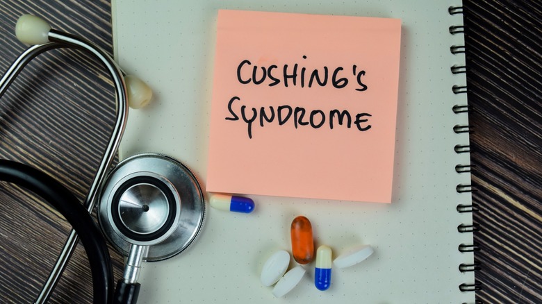 Post-it note with "Cushing's Syndrome" written on it surrounded by medical equipment