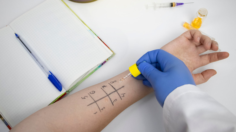 Doctor conducting allergy test on arm