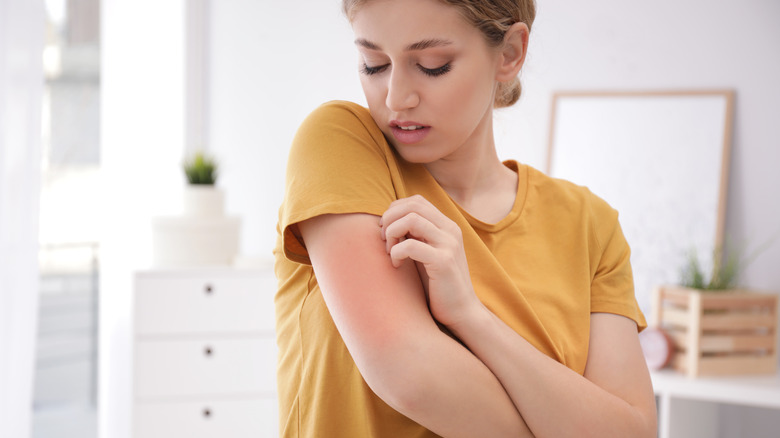 Young woman scratching her arm