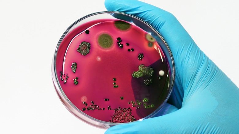 e. coli bacteria