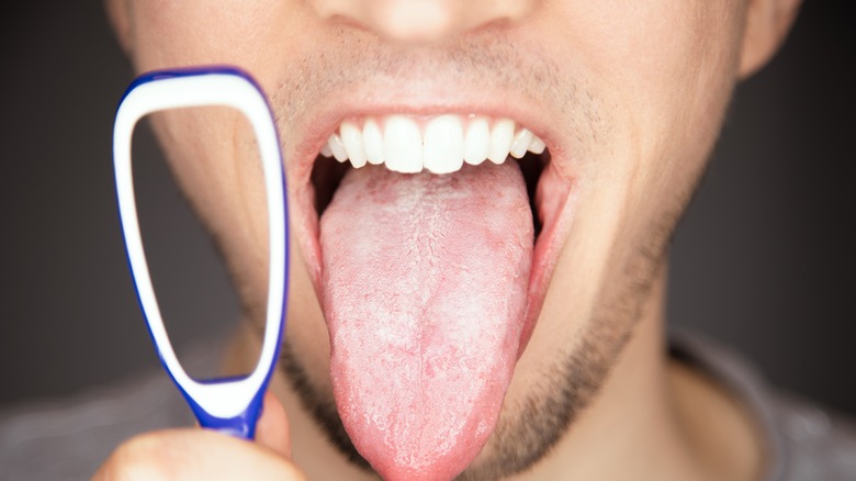 Person with tongue scraper and scraped tongue