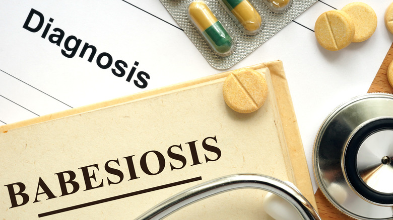 Concept photo of babesiosis diagnosis and treatment