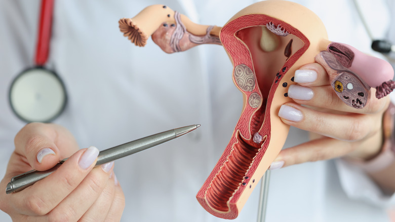 Doctor points at female reproductive system