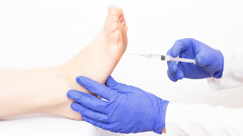 Botox in foot