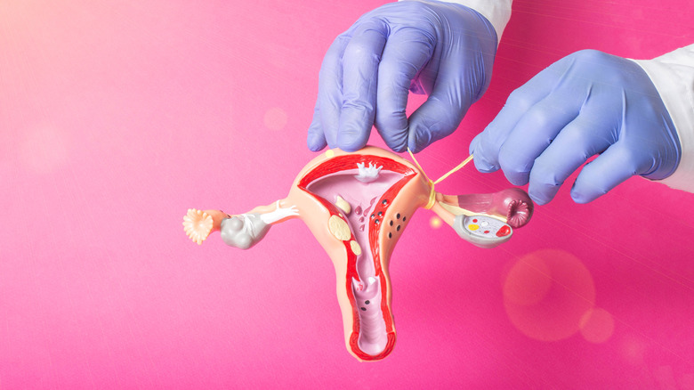 gynecologist uses model of a uterus 