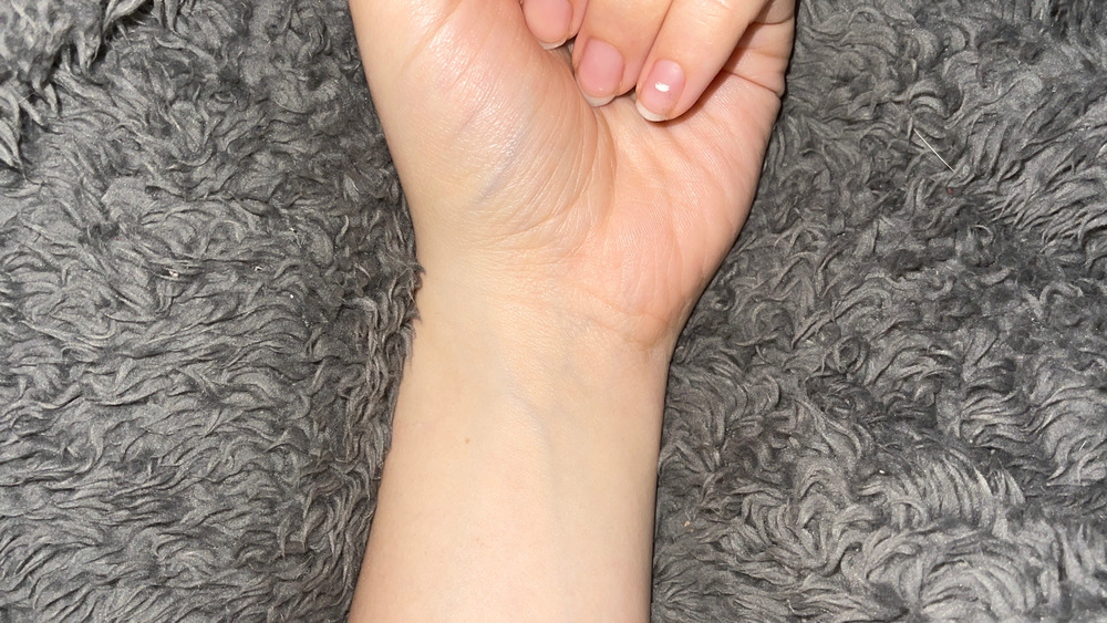 Wrist without a palmaris longus