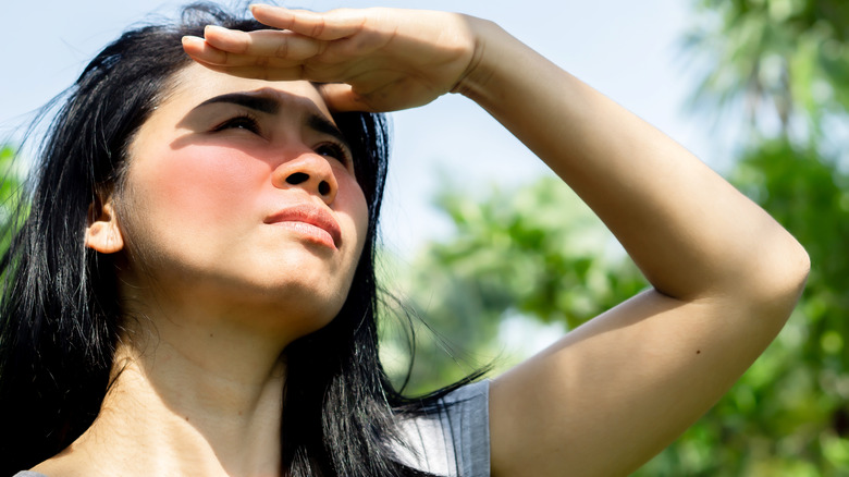 woman with sunburn