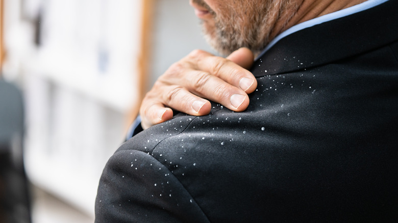 Closeup of dandruff on suit shoulder with man reaching to brush it off