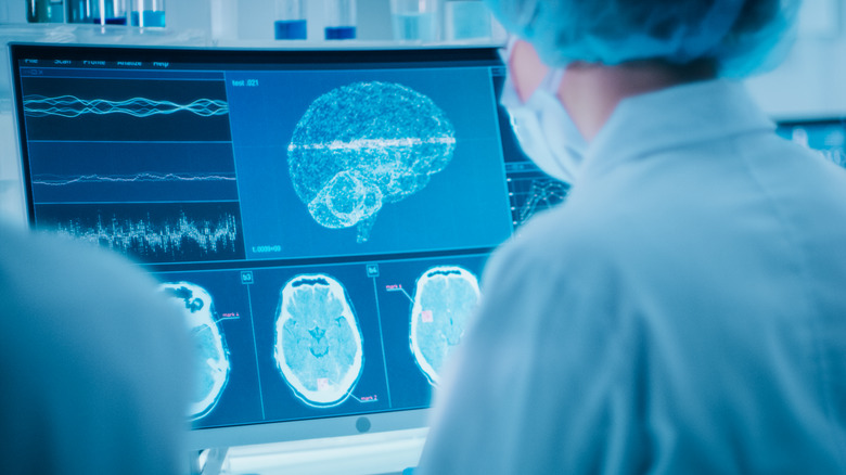 Doctor examining brain waves scan