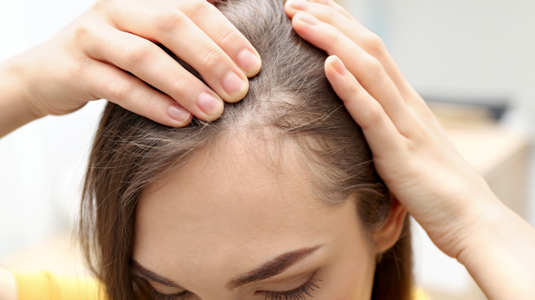 Woman examining hair loss on scalp