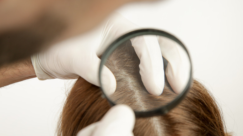 Doctor using magnifying glass to examine woman's scalp