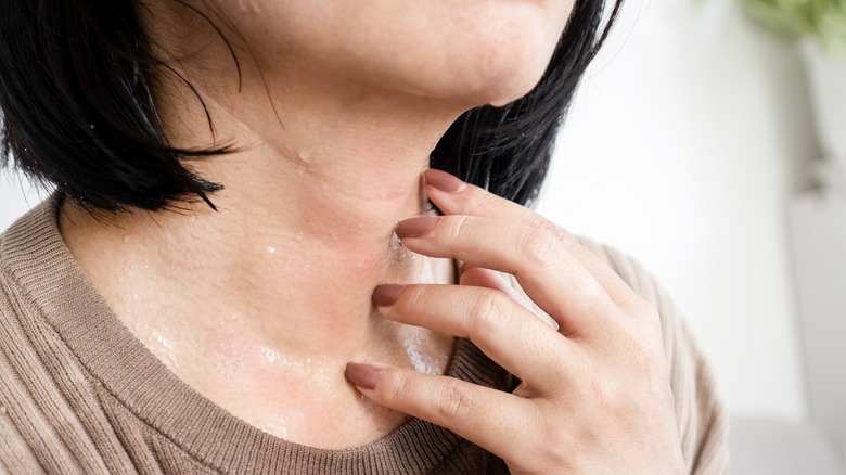 Woman scratching sweaty skin