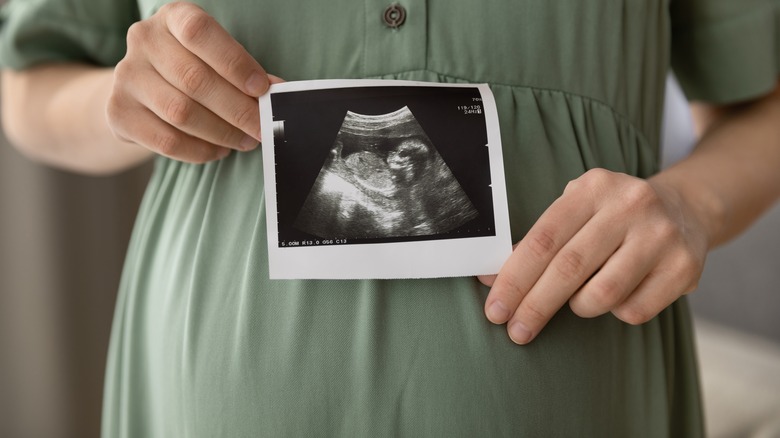 Pregnant woman holding ultrasound