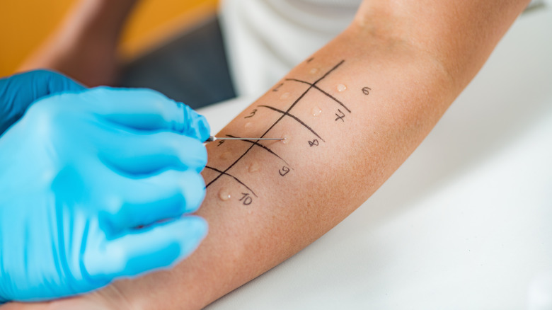 Immunologist doing skin prick allergy test on a woman's arm