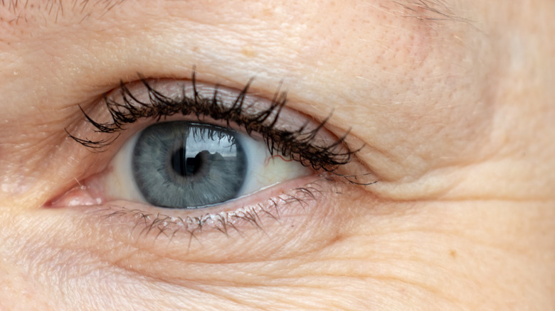 Closeup of eye wrinkles