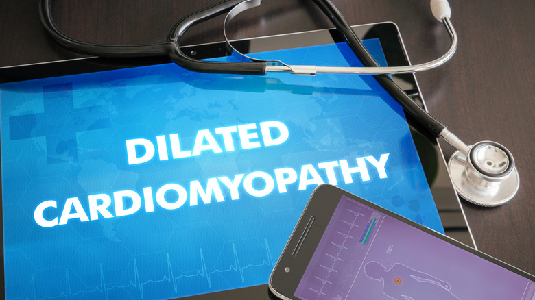 dilated cardiomyopathy written out on tablet with stethoscope and phone
