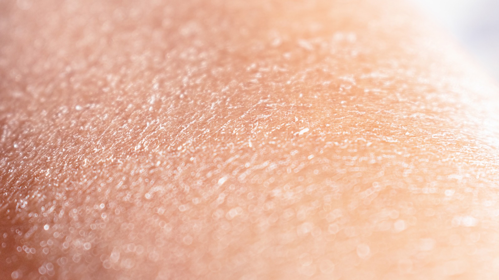 13 Causes Of Peeling Skin You Might Not Know