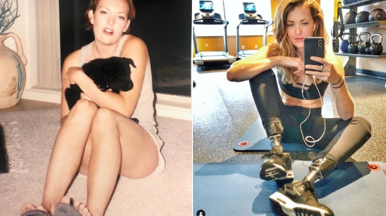 Amy Purdy, before and after