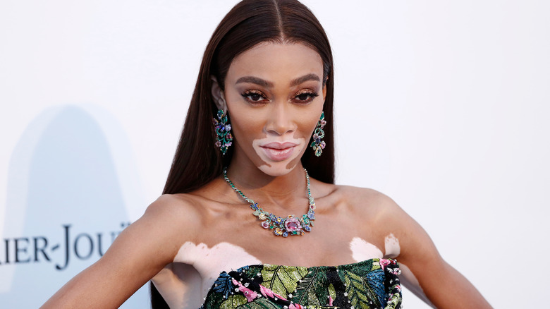 Winnie Harlow