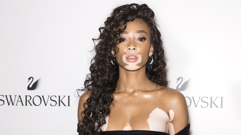 Winnie Harlow has nothing to hide