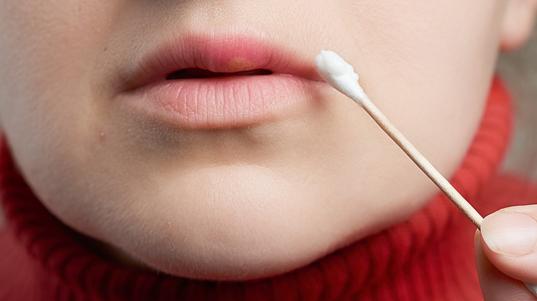 Woman applying ointment with Q-tip