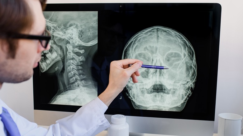 Doctor analyzing panasal sinuses