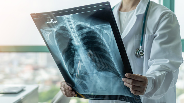 Doctor analyzing X rays of patient with cystic fibrosis