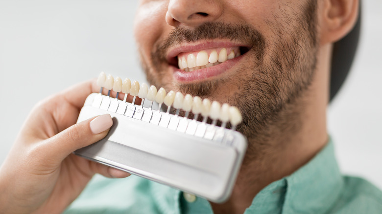 Dentist color-matching dental veneers to man's teeth