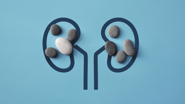 Drawing of kidneys with stones laid on top