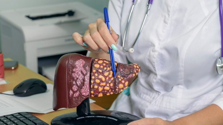 liver model